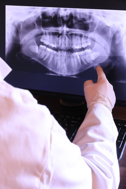 Best Emergency Wisdom Teeth Removal in Underwood, IA